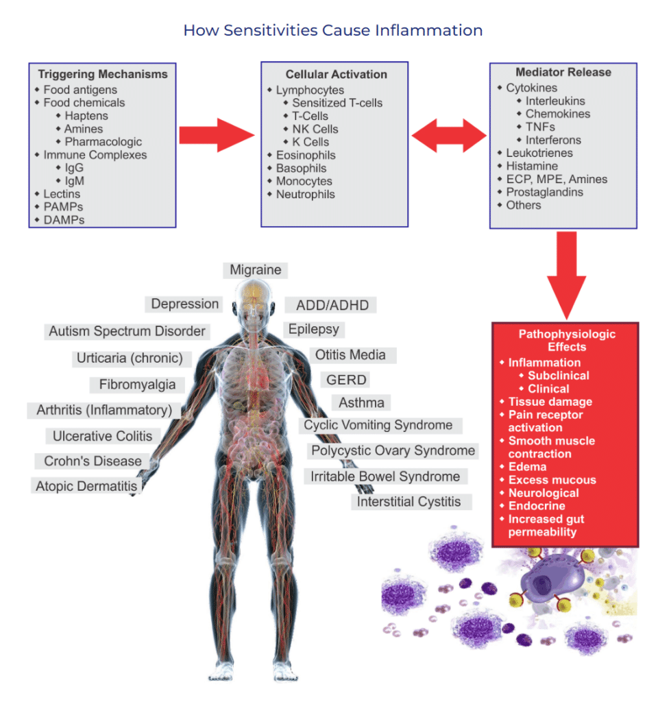 How Food reactions can cause chronic pain and inflammation. Triggering Mechanisms
• Food antigens
• Food chemicals
• Haptens
• Pharmacologic
• Immune Complexes
• IgM
• Lectins
. pAMPs
• DAMPsCellular Activation
• Lymphocytes
• Sensitized T-cells
• T-Cells
• Cells
• Eosinophils
• Basophils
• Monocytes
• Neutrophils
Migraine
Depression
Autism Spectrum Disorder
Urticaria (chronic)
Fibromyalgia
Arthritis (Inflammatory)
Ulcerative Colitis
Crohn's Disease
Atopic Dermatitis
ADD/ADHD
Epilepsy
Otitis Media
GERD
Asthma
Cyclic Vomiting Syndrome
Polycystic Ovary Syndrome
Irritable Bowel Syndrome
Interstitial Cystitis
Mediator Release
• Cytokines
• Interleukins
• Chemokines
TNFs
• Interferons
• Leukotrienes
• Histamine
• ECR MPE, Amines
• Prostaglandins
Others
Pathophysiologic
Effects
• Inflammation
• Subclinical
• Clinical
• Tissue damage
• Pain receptor
activation
• Smooth muscle
contraction
• Edema
• Excess mucous
• Neurological
• Endocrine
• Increased gut
permeability