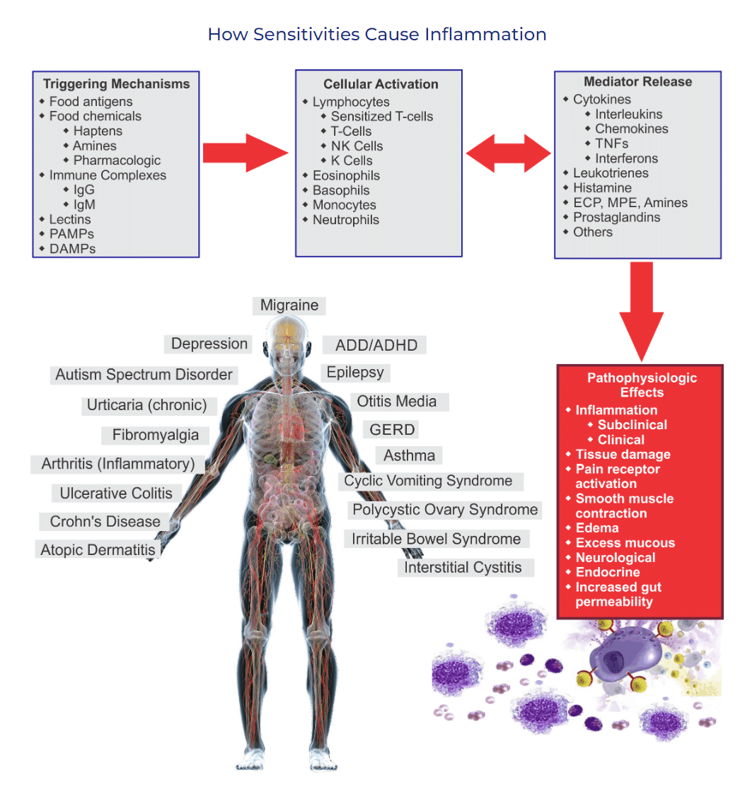 How Food reactions can cause chronic pain and inflammation. Triggering Mechanisms • Food antigens • Food chemicals • Haptens • Pharmacologic • Immune Complexes • IgM • Lectins . pAMPs • DAMPsCellular Activation • Lymphocytes • Sensitized T-cells • T-Cells • Cells • Eosinophils • Basophils • Monocytes • Neutrophils Migraine Depression Autism Spectrum Disorder Urticaria (chronic) Fibromyalgia Arthritis (Inflammatory) Ulcerative Colitis Crohn's Disease Atopic Dermatitis ADD/ADHD Epilepsy Otitis Media GERD Asthma Cyclic Vomiting Syndrome Polycystic Ovary Syndrome Irritable Bowel Syndrome Interstitial Cystitis Mediator Release • Cytokines • Interleukins • Chemokines TNFs • Interferons • Leukotrienes • Histamine • ECR MPE, Amines • Prostaglandins Others Pathophysiologic Effects • Inflammation • Subclinical • Clinical • Tissue damage • Pain receptor activation • Smooth muscle contraction • Edema • Excess mucous • Neurological • Endocrine • Increased gut permeability